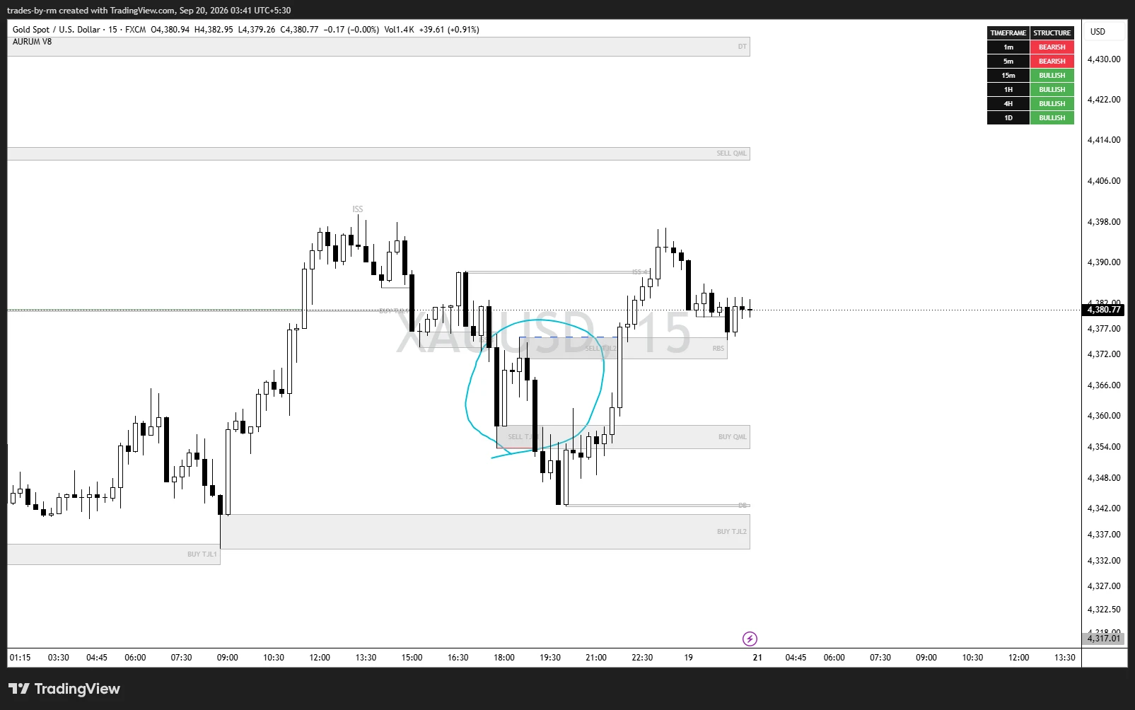 TradesByRM annotated XAUUSD chart review showing structure and a highlighted decision area
